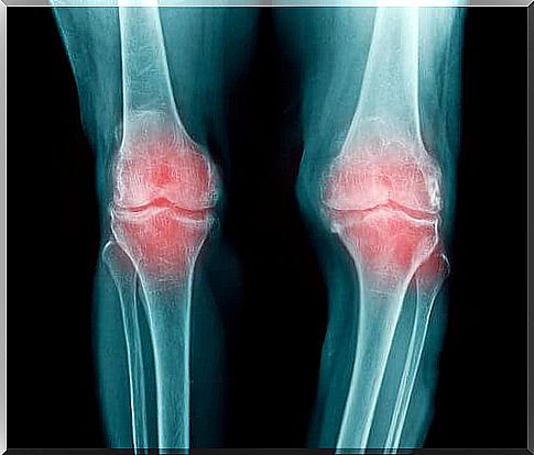 Information on osteoarthritis.