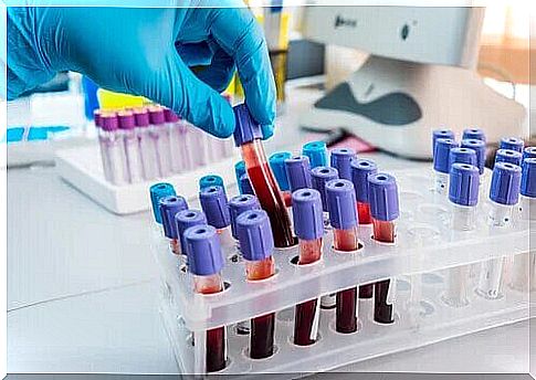 Neutropenic patients are detected through blood tests