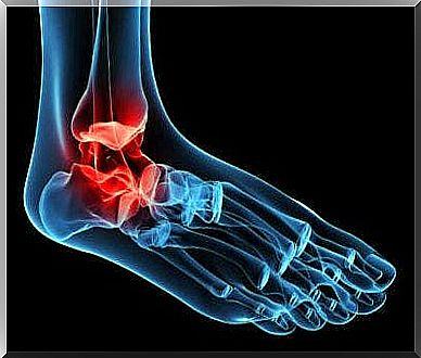 A representation of tendinopathy